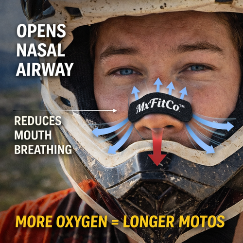 MxFitCo Nasal Strips